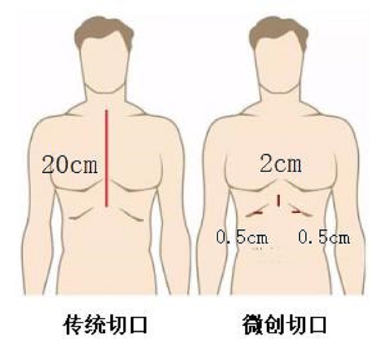 \